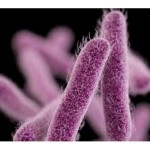Shigella outbreak affects over 100 people in California, Report