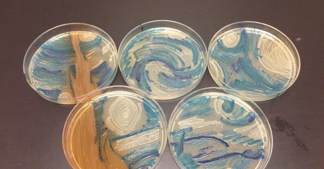 ‘Starry Night’ recreated with bacteria in a petri dish ‘Photo’