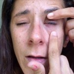 Woman glues eye shut after Visine, super glue mixup (Video)