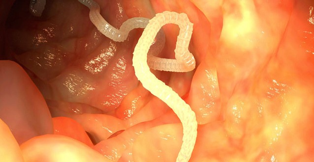Tapeworm Cancer Develops Inside Colombian Man's Lungs, Killing Him after Diagnosis : CDC reports