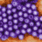 California: Norovirus - aka Winter Vomiting Disease - Is on the Rise, officials warn