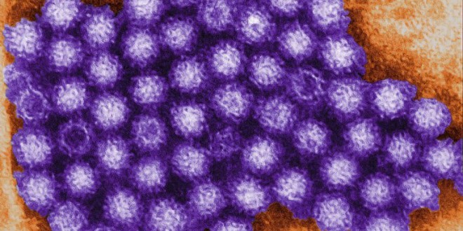 California: Norovirus - aka Winter Vomiting Disease - Is on the Rise, officials warn