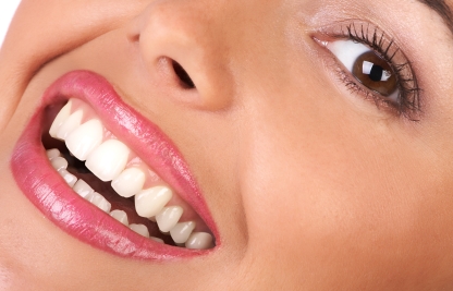 Frequent home tooth whitening causes damage, Says UBC Expert