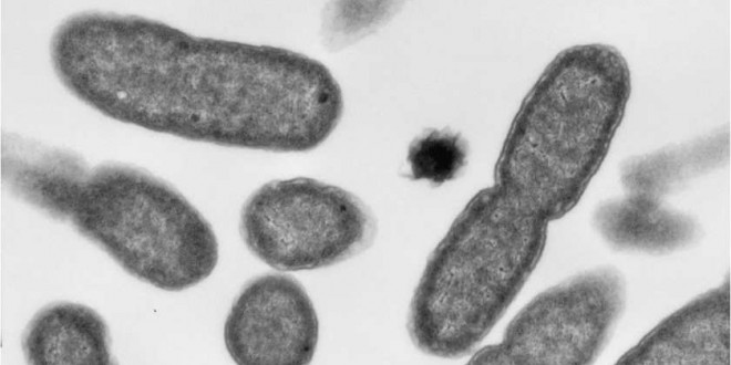 Researchers find superbug gene in three cases