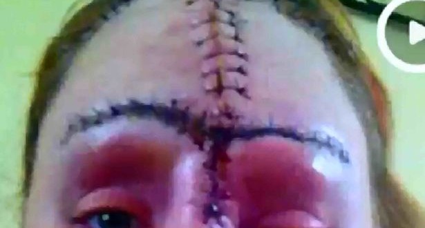 Sam Davies, Mum's birthmark EXPLODED, then docs found three deadly tumours behind it