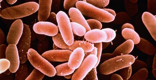 Seven hospitalized in Five provinces affected by Listeria outbreak, Ministry of Health says