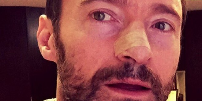 Hugh Jackman: X-Men star has another skin cancer growth removed