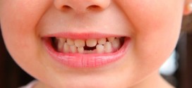 Research shows tooth decay worsened in Calgary children after fluoride removal
