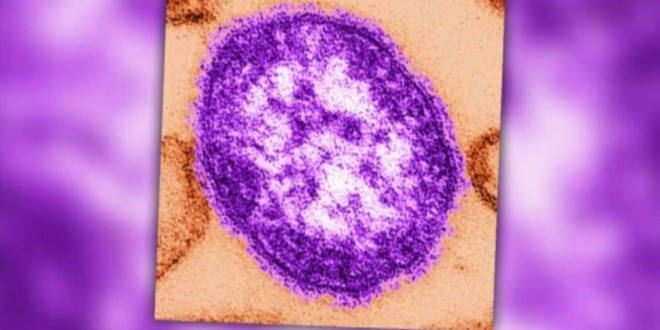 Health officials warn of possible measles exposure in Brampton, Ont: Report