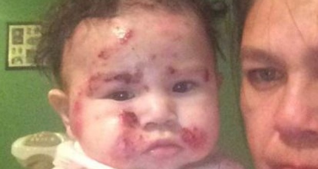 No medical emergency among Kashechewan kids, Report