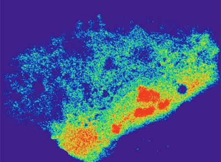 Researchers May Have Found the Key to Curing Autism, Cancer and HIV
