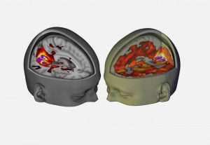 First scans show how LSD affects the brain, Study