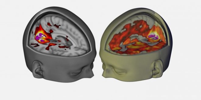 First scans show how LSD affects the brain, Study
