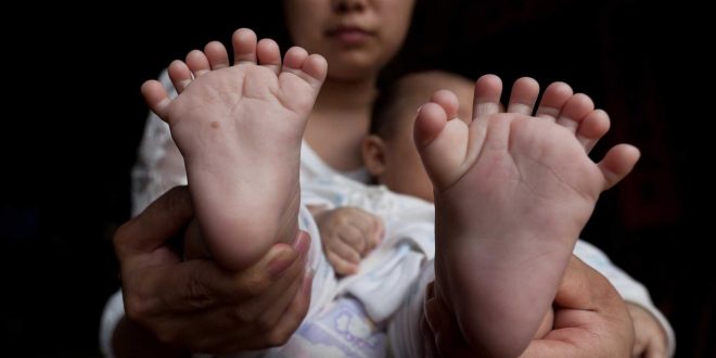 Baby born with 31 fingers, toes, parents seek help (Photo)