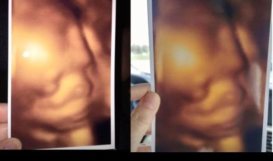 Expecting mothers say Pickering clinic gave them identical 3D ultrasound images