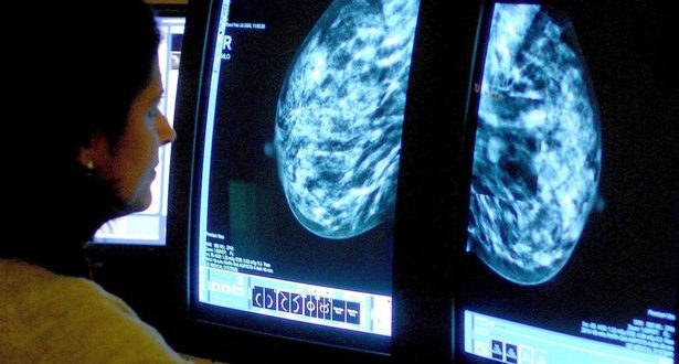 Financial crisis linked to over 200000 cancer-related deaths, says new research