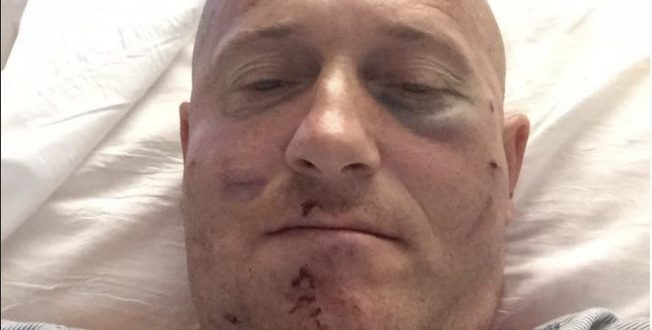 Richard Ojeda: Candidate for WV State Senate injured in attack “Photo”