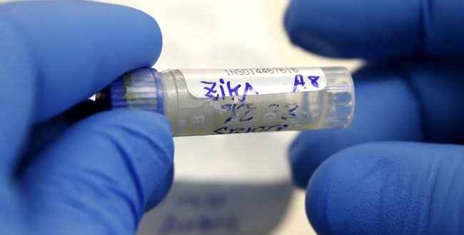 Urine More Accurate Than Blood for Zika Testing, CDC Says