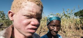 Malawi: Albino Deaths for Body Parts On the Rise, Report