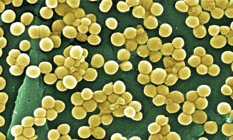 UV light kills MRSA without damaging human tissue, Research