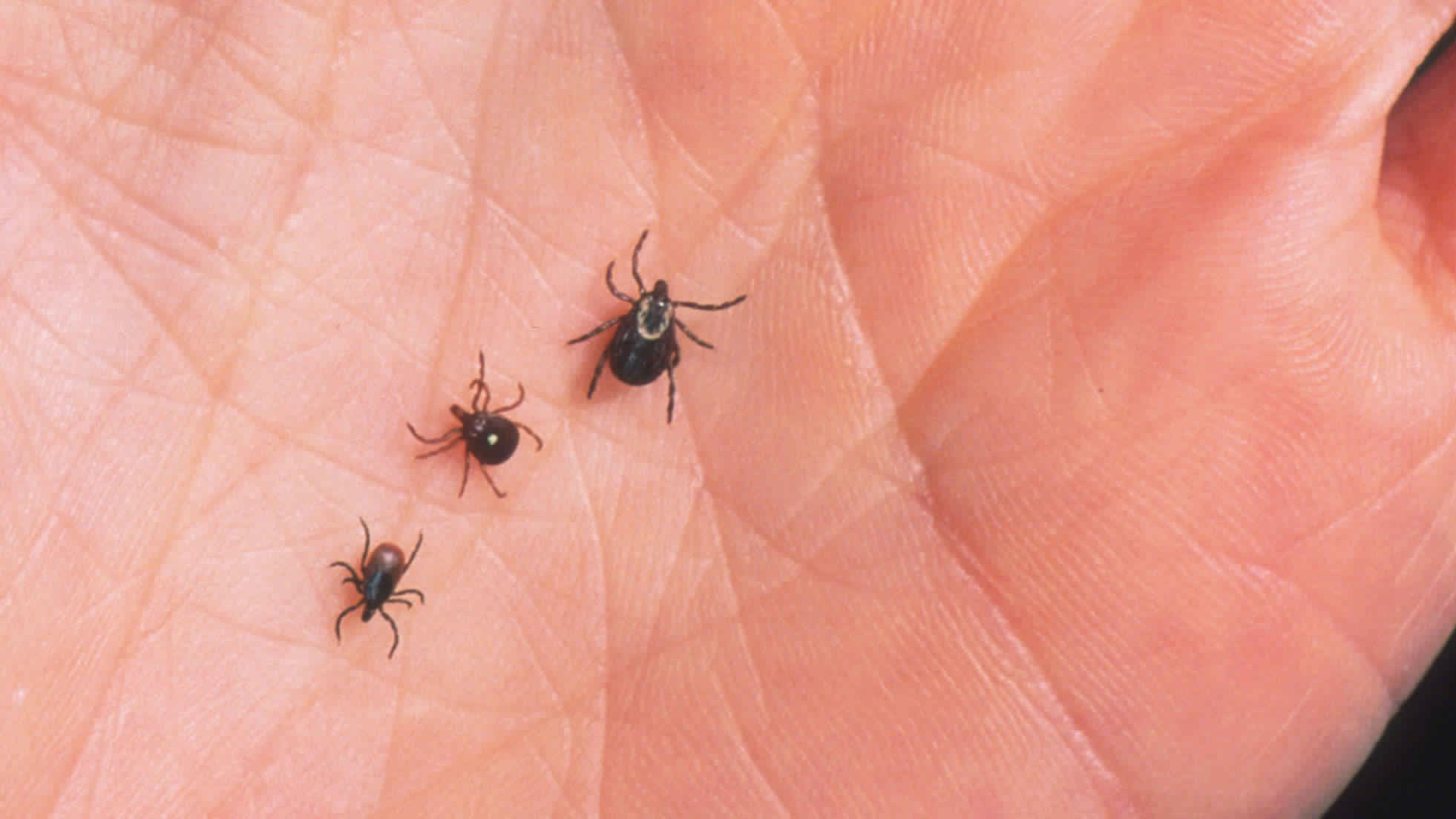 It's Tick Season: Protecting Yourself Against Lyme Disease - Canada
