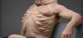 Meet Graham: The ideal body type to survive a car crash