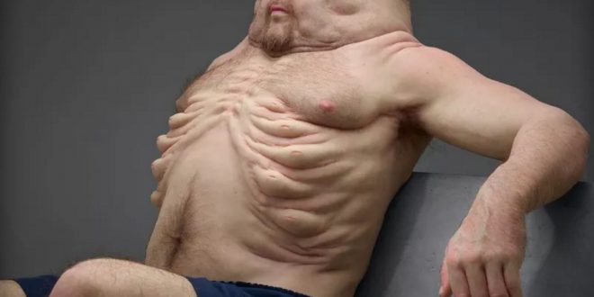 Meet Graham: The ideal body type to survive a car crash