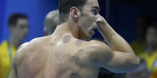 Michael Phelps Leads the Rio Cupping Craze (Photo)
