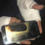 Amarjit Mann Says Galaxy S7 Exploded In His Hand