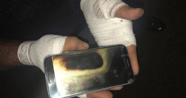 Amarjit Mann Says Galaxy S7 Exploded In His Hand (Photo)