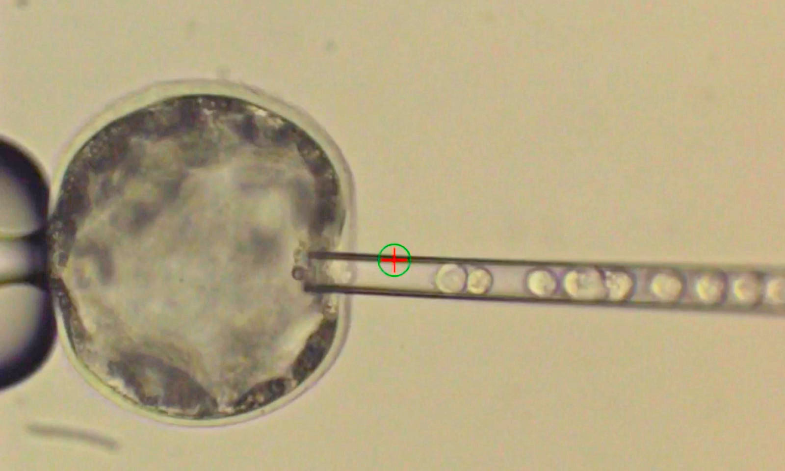 Human stem cells grown in pig embryos (new research) Canada Journal