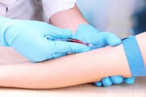 Parkinson's Disease: Blood Test Facilitates Parkinson Diagnosis, Says New Study
