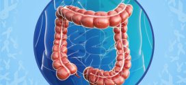 Colorectal cancer on the rise in millennials, says new study