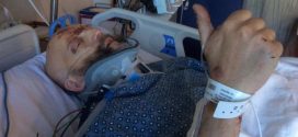 Harry Potter actor Jim Tavare breaks neck, Punctured Lung from Car Accident