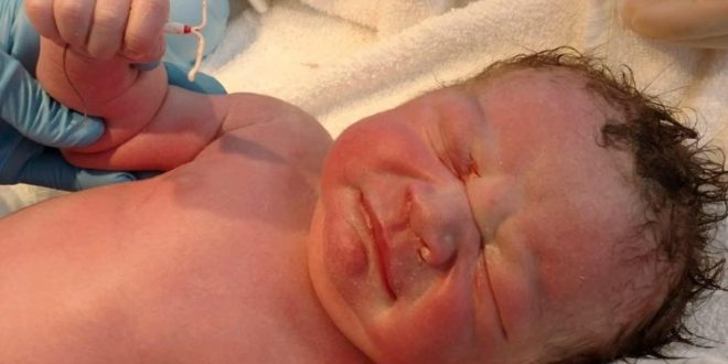 Baby born clutching his mother’s birth control coil (Photo)