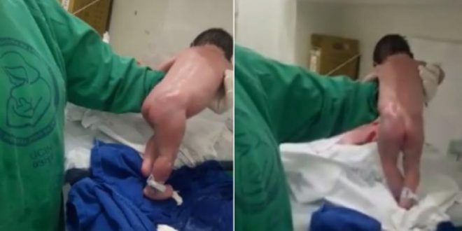 Baby shocks medical staff by walking minutes after birth (Video)