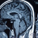 Scientists Restore Consciousness in Man After 15 Years in a Vegetative State