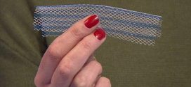 Ella Ebaugh Wins $57M Vaginal Mesh Lawsuit