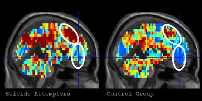 Researchers develop program to identify suicidal thoughts