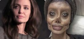 Teen has 50 surgeries to look like Angelina Jolie (Photo)