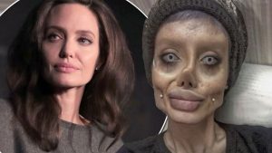 Teen has 50 surgeries to look like Angelina Jolie (Photo)