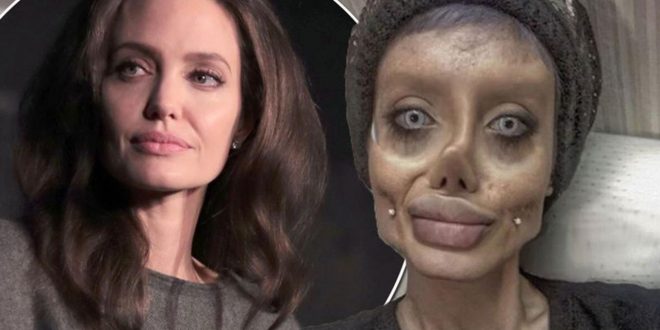 Teen has 50 surgeries to look like Angelina Jolie (Photo)