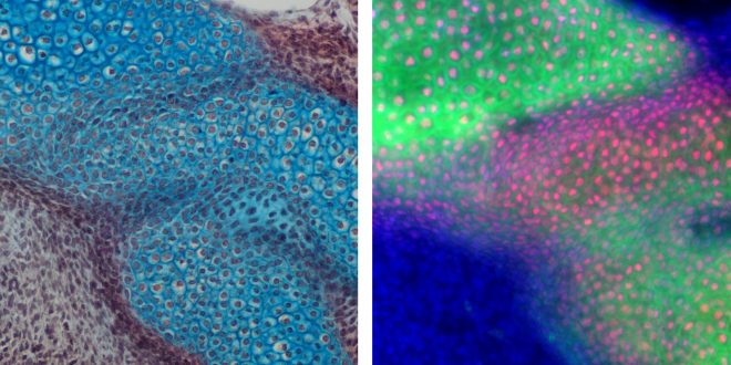 Hints at jaw evolution found in marsupials and monotremes (Study)